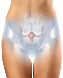 pcos